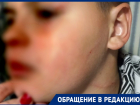 "Сумасшедшая мамаша!": в парке 300-летия Таганрога на детей напала местная жительница 