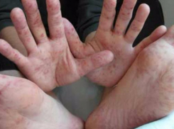 Управление здравоохранения развеяли панику среди таганрожцев о бушующем в городе вирусе