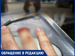 Откушенный палец - мрачный символ конфликта с участием сотрудников правоохранительных органов в Таганроге