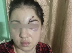 Таганрожец жестоко избил собаку а потом и хозяйку: женщина попала в больницу