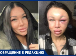Популярного косметолога Таганрога избил до неузнаваемости её молодой человек