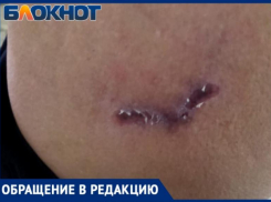 «Собака бывает кусачей»: таганроженку искусала свора собак