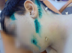 В Таганроге посреди дня мужчина нанес ребенку 9 ножевых ранений