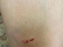 И вновь новая жертва бездомных собак в Таганроге