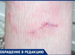  Еще одна жертва бездомных животных в Таганроге – собаки искусали 13-летнего подростка