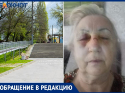 70-летняя таганроженка пострадала из-за узких ступенек в роще Дубки