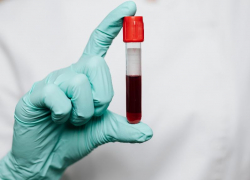 В Таганроге можно сдать кровь для пострадавших в ходе СВО бойцов