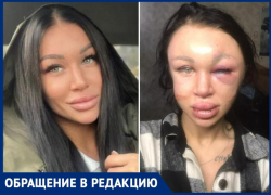 Популярного косметолога Таганрога избил до неузнаваемости её молодой человек