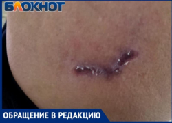 "Собака бывает кусачей": таганроженку искусала свора собак