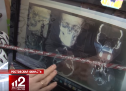 "Рудик ни в чём не виноват" - уже 2 года полиция Таганрога не задерживает подозреваемого в жестоком избиении