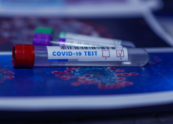 В Таганроге за сутки подтвердились 19 новых случаев  COVID-19