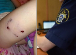 Следователи проверяют информацию о нападении собак на жителей Таганрога