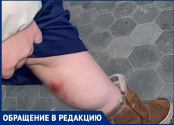 В Таганроге бездомная собака искусала 15-летнюю девочку