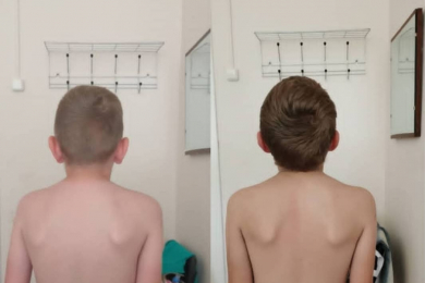 Остеопат Игорь Брук. Помощь при аутизме - 